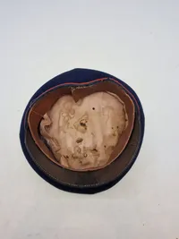 Original Tysk WW1 kasket