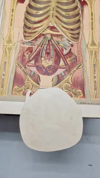 Medicology: Home Encyclopedia of Health", som er en omfattende familieguide til sundhed og medicin fra begyndelsen af 1900-tallet